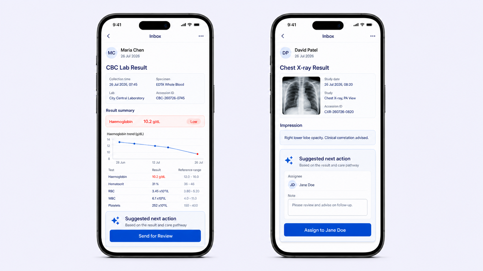 Inbox action prediction